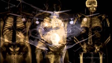 All Out – Mentally Disturbed [breaks]